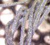 Nebula Necklace, 200xMagnification, 2011.: Nebula Necklace, 200xMagnification, 2011.