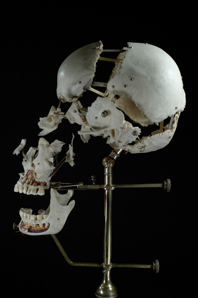 Ryan Matthew Cohn; Exploded/Beauchene Human Skull, 2012–14: Bone, antique brass;  Photo: Sergio Royzen